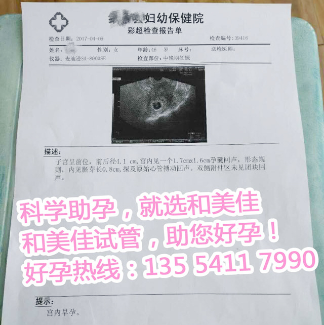 彩超检查报告单