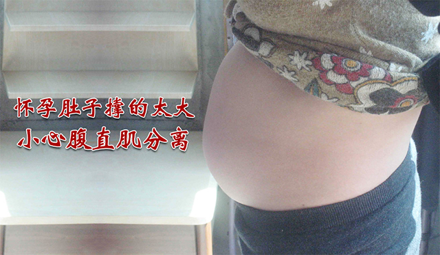 怀孕肚子撑的太大,小心腹直肌分离