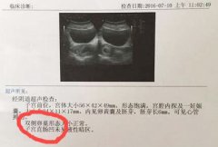 韵心公司教你怎么看孕期B超单