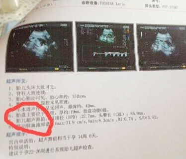 韵心公司教你怎么看孕期B超单