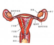 这5种妇科疾病容易造成输卵管堵塞