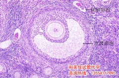 卵泡发育不良该如何调理